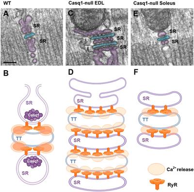 Ablation of Calsequestrin-1, Ca2+ unbalance, and susceptibility to heat stroke